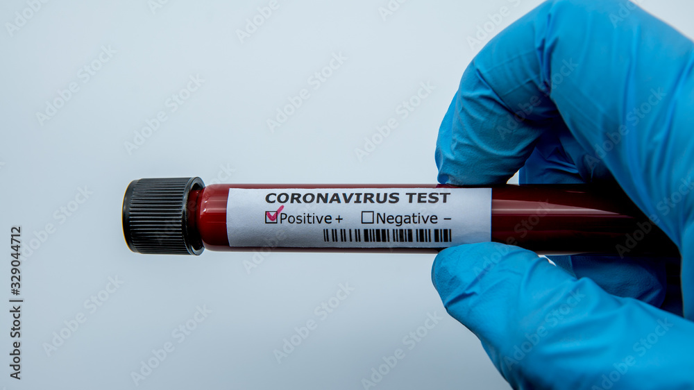 Obraz premium Surgical gloves with a positive coronavirus infected blood sample test.