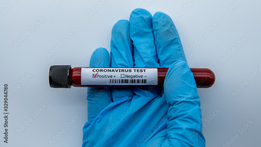 Obraz premium Test tube with infected blood sample for COVID-19, coronavirus from Wuhan