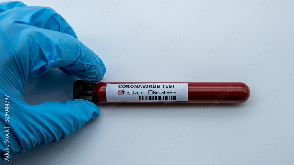 Obraz premium Laboratory technician hand hold blood sample tube for corona virus test