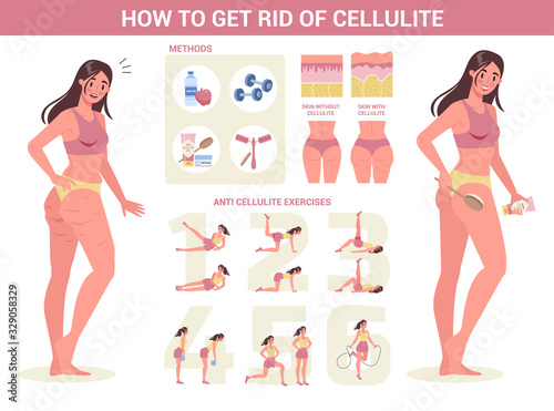How to get ride of cellulite instruction. Beauty tips for smooth skin.