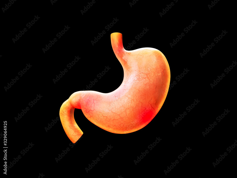 stomach pain, heartburn, stomach anatomy, human digestive system, acids, nausea, seasickness, vomiting, Gastritis and acid reflux, indigestion and stomach pain problems stomach pain, heartburn, stomach anatomy, human digestive system, acids, nausea, seasickness, vomiting, Gastritis and acid reflux, indigestion and stomach pain problems