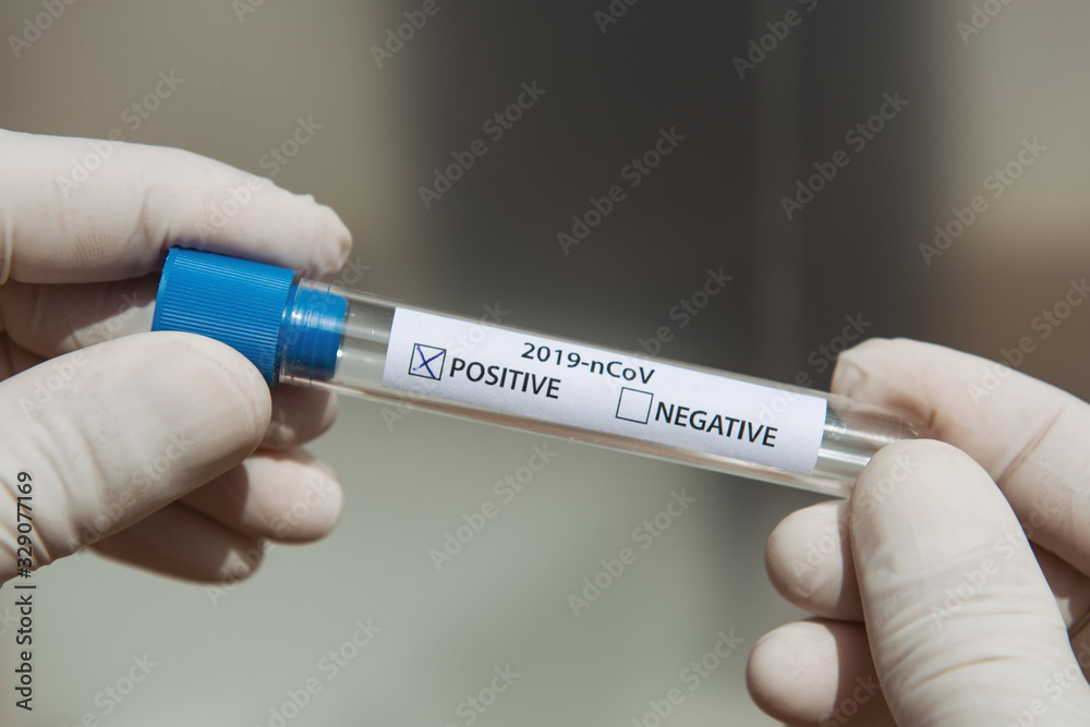 Fototapeta premium Soft focus hands of a lab technician with test tube. Positive result.