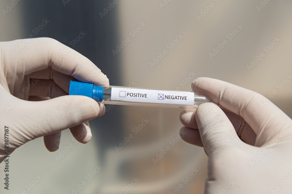 Fototapeta premium Soft focus hands of a lab technician with test tube. Negative result.