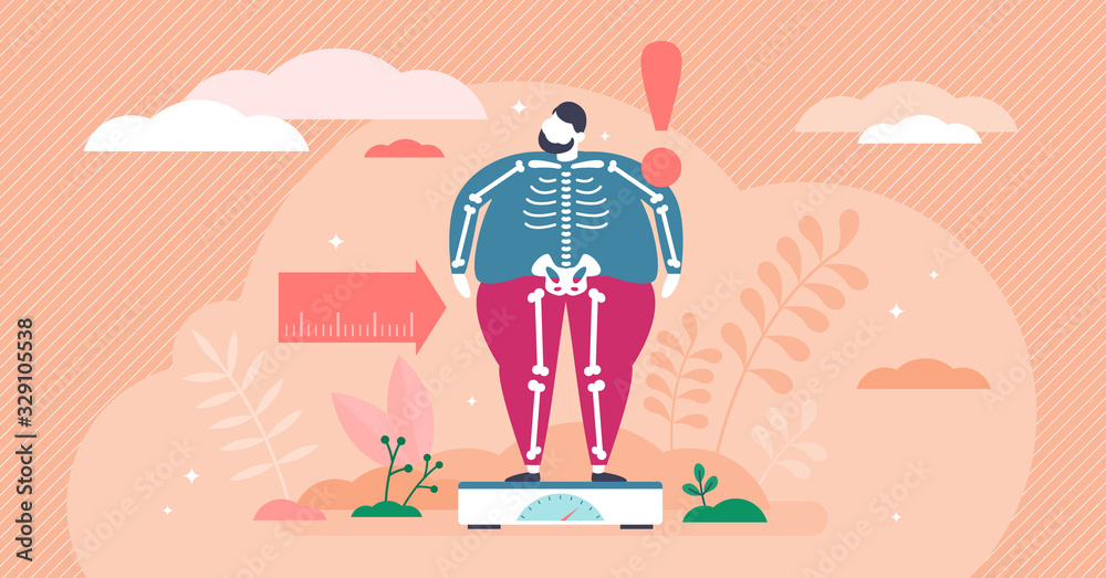 Overweight concept, flat tiny person vector illustration Overweight concept, flat tiny person vector illustration
