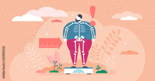 Overweight concept, flat tiny person vector illustration photo