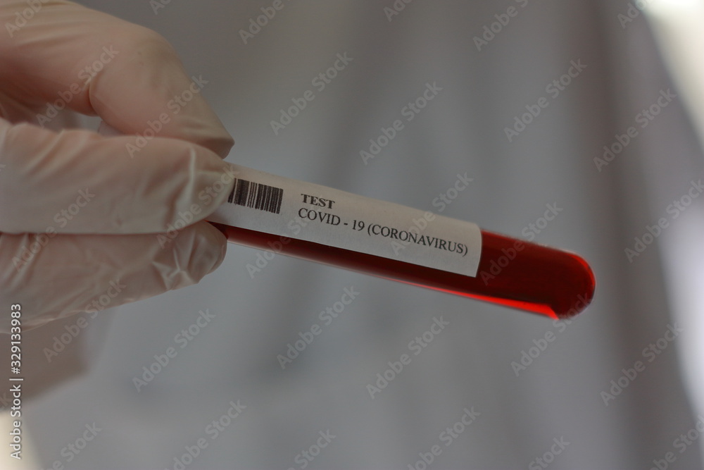 Obraz premium TEST CORONAVIRUS DE WUHAN (COVID -19) 