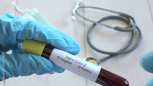 Physician marking COVID-19 disease positive blood test results, 2019-nCoV , analyst with blue gloves report Sars-CoV-2 infection check up, doctor hands writing Coronavirus diagnosis on test tube