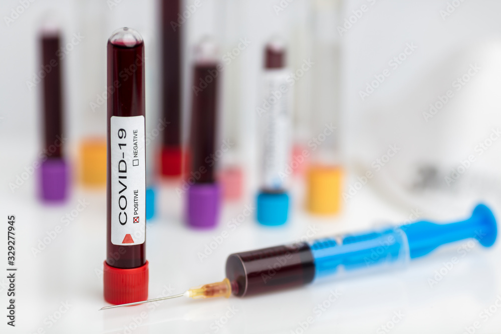 Naklejka premium Laboratory sample of the novel Coronavirus