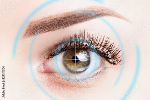 Refractive surgery, eye laser surgery concept. Female eye close up with blue laser rays photo