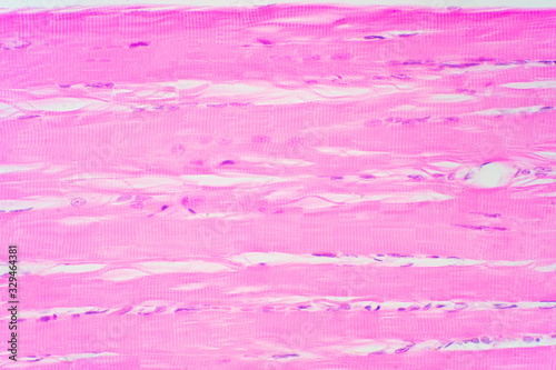 Canvas Print Human skeletal muscle under microscope view for education pathology