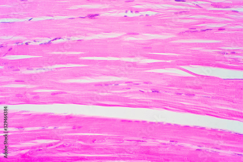 Human skeletal muscle under microscope view for education pathology. photo