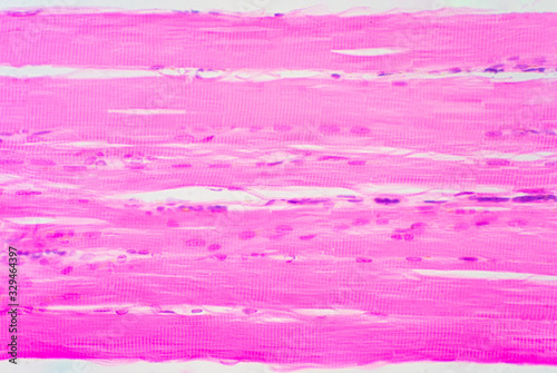 Fotografie Human skeletal muscle under microscope view for education pathology