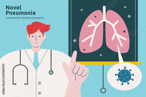 Doctor explaining Novel pneumonia