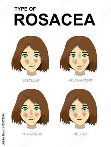 Manga Cartoon Type of Rosacea Woman Set