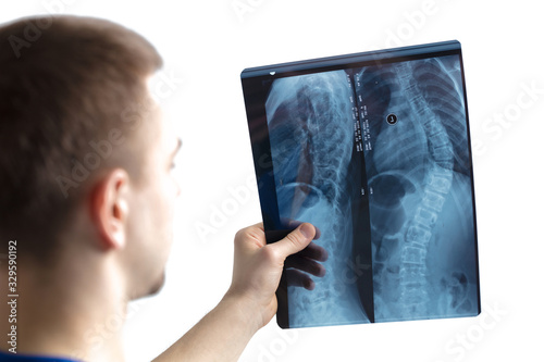The doctor examines the x-ray image of the spine.The doctor is holding a photo of fluorography on a white background