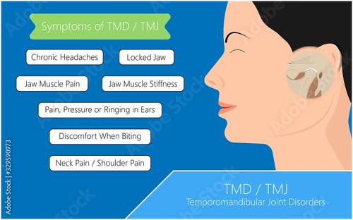 Temporomandibular Joint Disorders TMD TMJ treat pain displaced disc temporal bone locking bite plate plastic guard night Transcutaneous electrical nerve stimulation TENS Arthroscopy occlusal oral