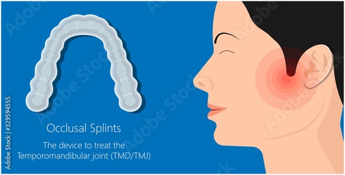 Temporomandibular Joint Disorders TMD TMJ treat pain displaced disc temporal bone locking bite plate plastic guard night Transcutaneous electrical nerve stimulation TENS Arthroscopy occlusal oral