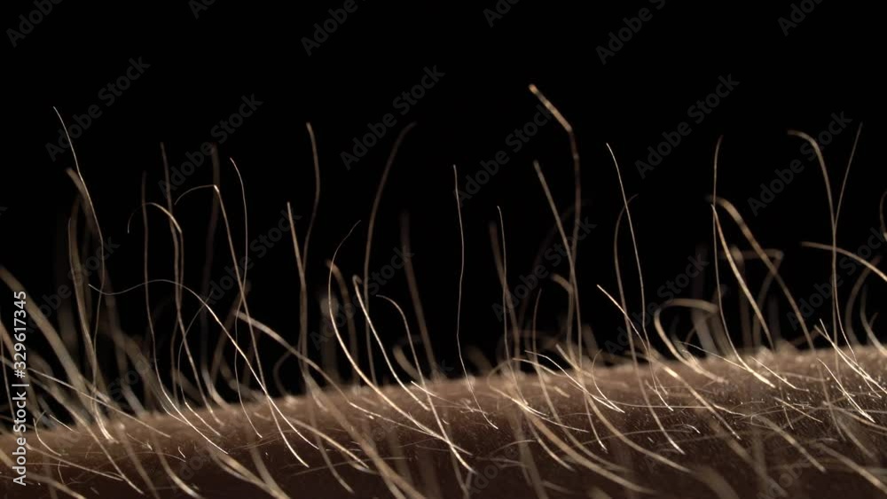 Slow motion macro of hair raising goose bumps on man arm skin caused by some strong emotions.