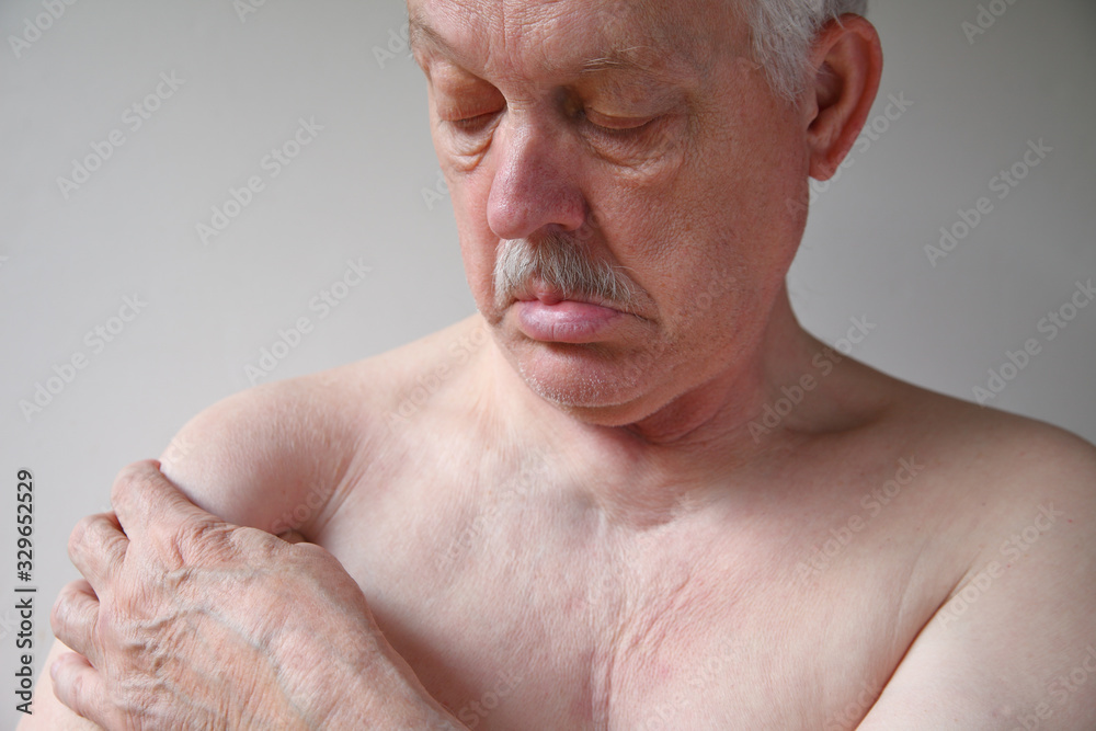 Older man has recurring pain in his shoulder Older man has recurring pain in his shoulder