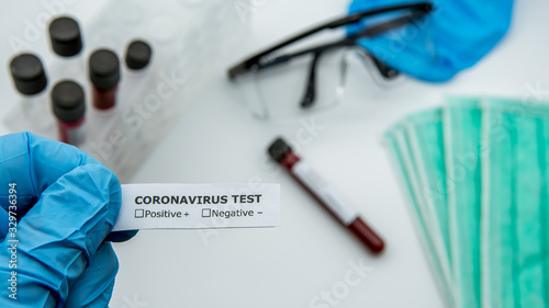 Scientist with identifier sticker for COVID-19 test  laboratory sample of blood.