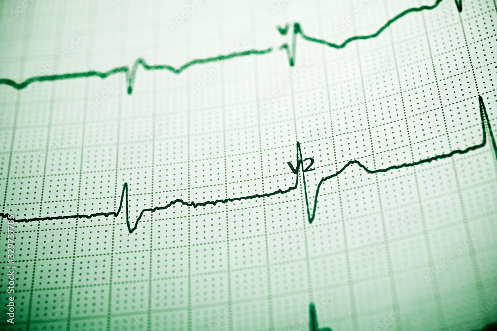 Electrocardiograph close up Electrocardiograph close up