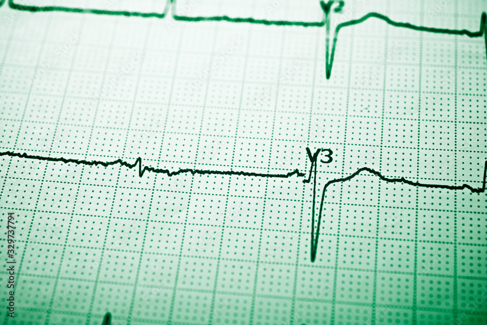 Electrocardiograph close up Electrocardiograph close up