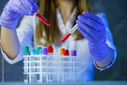 A medical professional, laboratory assistant, doctor performs an analysis in a laboratory, uses test tubes, a pipette and a petri dish for the presence of bacteria in the human body