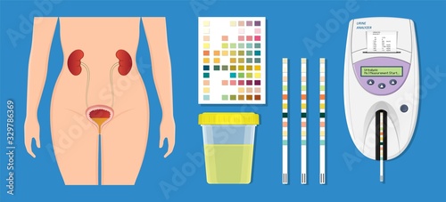 Urine tract exam doctor clinic kidney sick tool pee piss chart color test lab strip pH bottle digital result device medical machine screen science sample measure chronic ketone Diabetes annual
