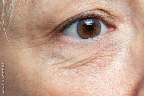 Macro detail of under eye wrinkles on middle aged woman.