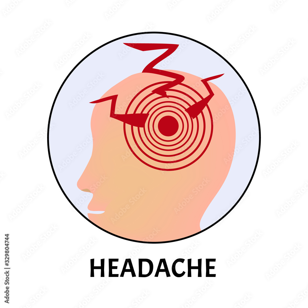 Headache. Symptom of influenza, allergies, bronchitis, pneumonia, sinusitis. Coronavirus. Icons headache. Infographics. Vector illustration on isolated background. Headache. Symptom of influenza, allergies, bronchitis, pneumonia, sinusitis. Coronavirus. Icons headache. Infographics. Vector illustration on isolated background.