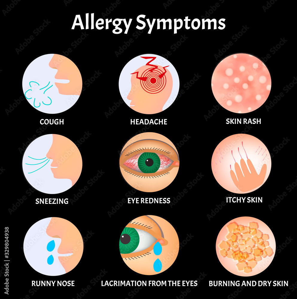 Symptoms of Allergies Skin rash, Allergic skin itching, Tearing from the eyes, Cough, Sneezing