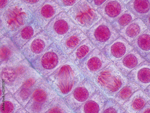 Cells of an onion root tip undergo mitosis. Anaphases and metaphases under microscope. photo