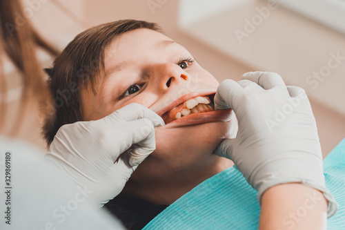 The orthodontist checks the boy for a bite of his teeth. photo