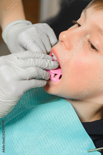 The boy orthodontist makes a fitting for the plate.