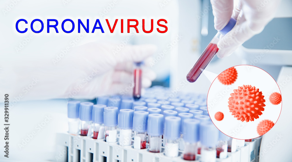 Biochemical laboratory test blood 2019-ncov virus . Pandemic vaccine coronavirus concept Biochemical laboratory test blood 2019-ncov virus . Pandemic vaccine coronavirus concept