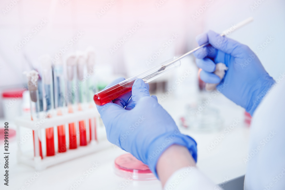 Nurse microbiologist holding test tube with blood for coronavirus 2019-nCoV analyzing