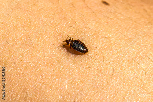 Bed Bug On Skin 