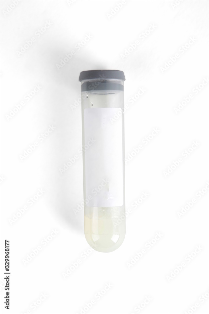 Covid-19, NCP, new coronavirus detection kit, nucleic acid detection reagent, antibody detection reagent, can detect whether the virus is positive, to ensure epidemic prevention and control. Covid-19, NCP, new coronavirus detection kit, nucleic acid detection reagent, antibody detection reagent, can detect whether the virus is positive, to ensure epidemic prevention and control.