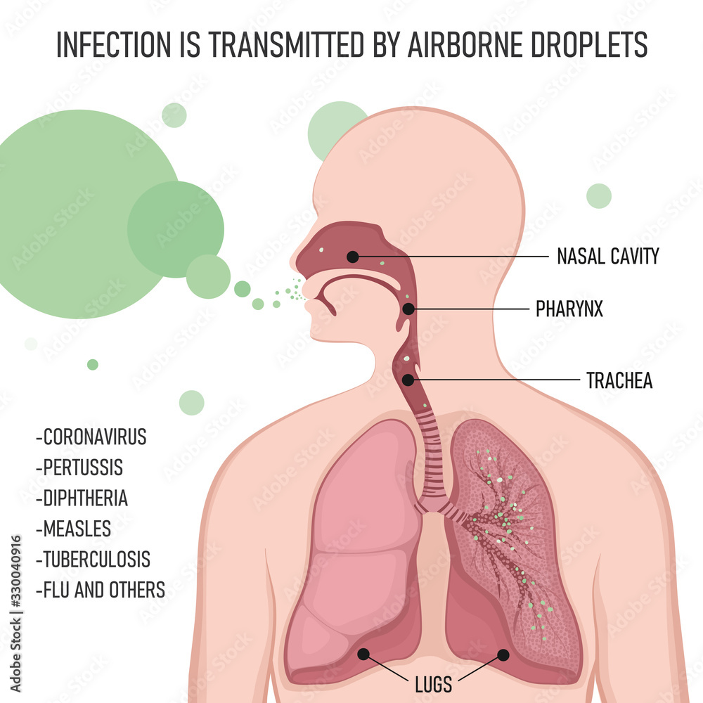 Obraz premium Infection is transmitted by airborne droplets. Human body with lungs affected by virus cells through the respiratory tract.