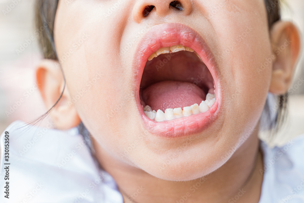 Oral and primary tooth health of children. Oral and primary tooth health of children.