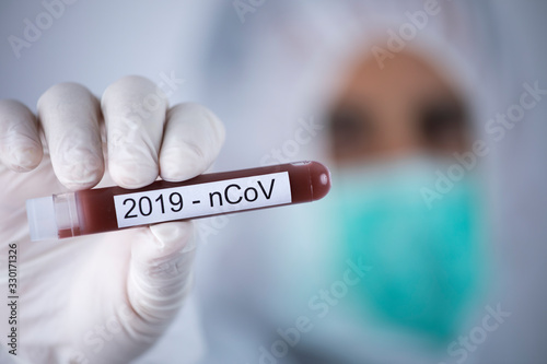 provetta con sangue per test su coronavirus, tenuta in mano da un medico photo