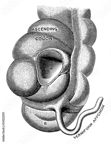 Vermiform appendix, vintage illustration.