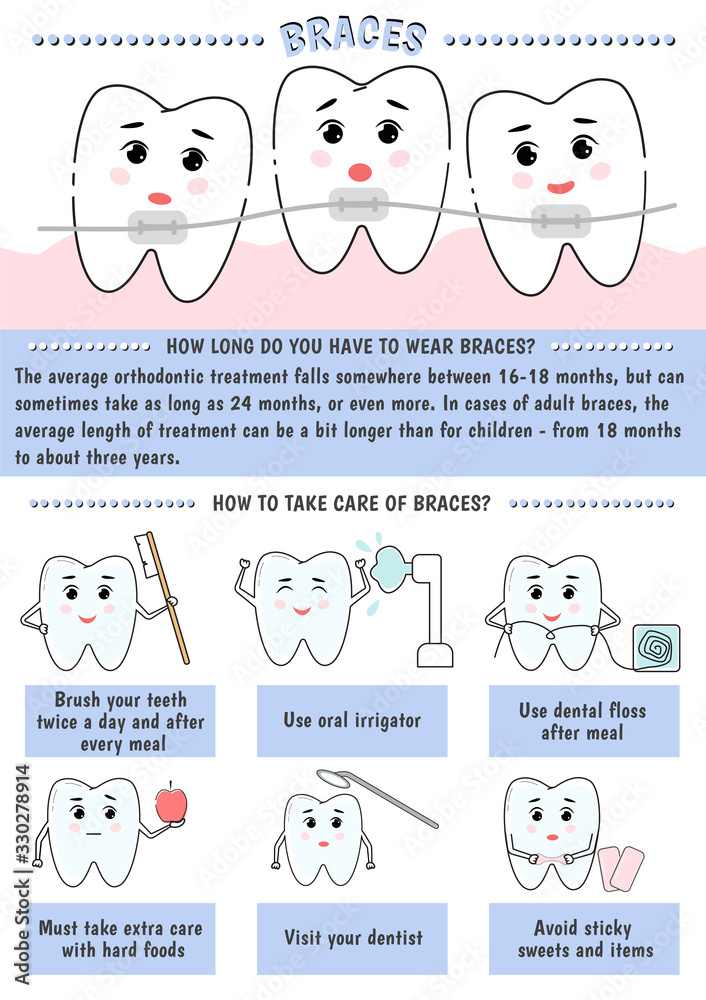 Medical infographics. Braces, care of braces. Teeth alignment. Concept for dentistry, orthodontists, dentists. Vector illustration.