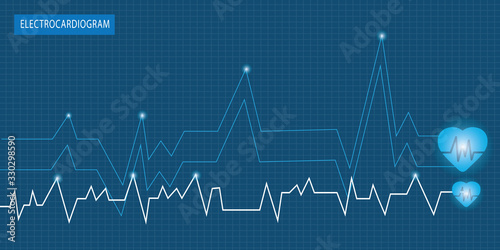 ECG heartbeat monitor, cardiogram heart pulse line wave. Electrocardiogram medical background.