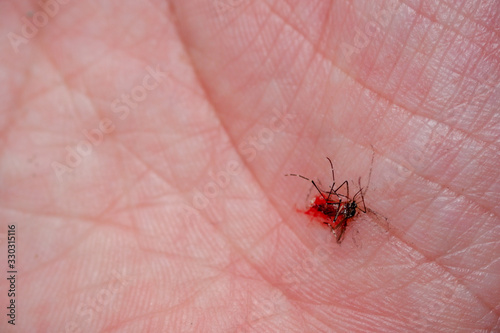 Mosquito was died with blood on plam hand of human.