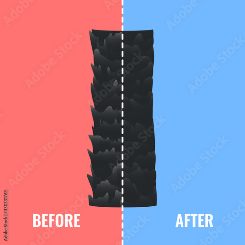 Damaged and healthy hair under the microscope. Hair follicle surface condition closeup. Trichology before and after medical concept. Vector illustration.