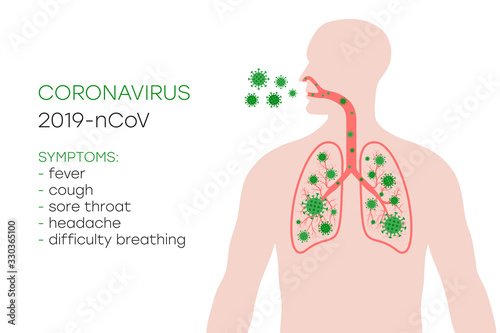 Coronavirus symptoms, 2019-nCoV. Human body with lungs affected by virus cells through the respiratory tract, by airborne droplets. Anatomy banner of Novel Coronavirus. Vector illustration.