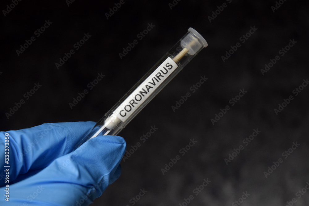 Obraz premium Coronavirus sample