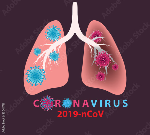 Cuadro en lienzo Coronavirus banner for awareness & alert against disease spread, symptoms or precautions