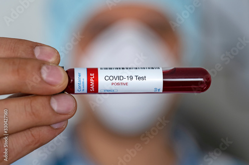 Doctor holding coronavirus blood test sample in tube photo